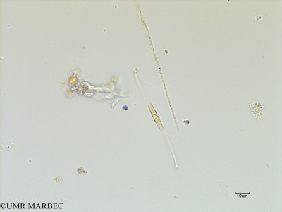 phyto/Scattered_Islands/iles_glorieuses/SIREME November 2015/Gyrosigma prolongatum (SIREME-Glorieuses2015-ech1-171116-Pleurosigma ou nitzschia-4)(copy)_thumb.jpg
